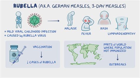 Video: Rubella (German measles): Nursing | Osmosis