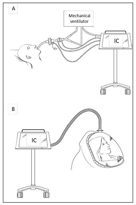 Indirect Calorimetry in Clinical Practice