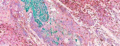 Virtual Advanced Staining Image Gallery