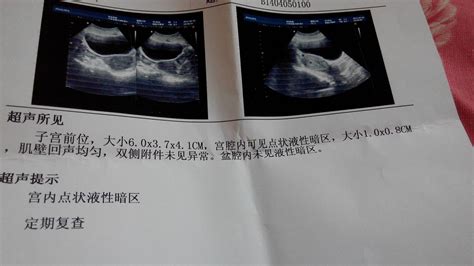 老婆怀孕13周的B超单，能看出男女吗 - 百度宝宝知道