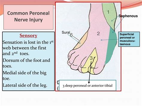 PPT - Sciatic Nerve: Anatomy, Injuries & Effects PowerPoint Presentation - ID:8701679