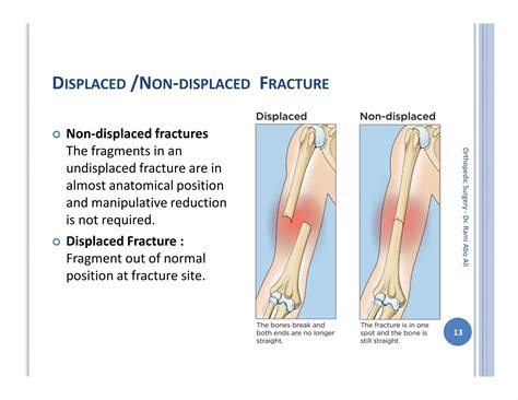 Orthopedic surgery 2nd general principles in fractures | PDF