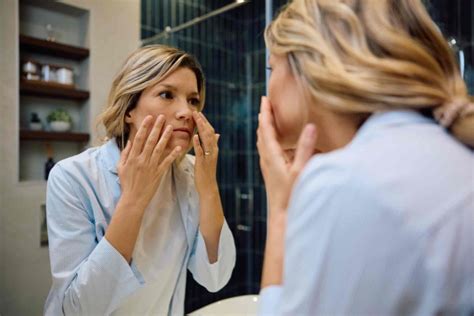 Under Eye Filler Migration: Can Tear Trough Filler Migrate? - Dkdermal