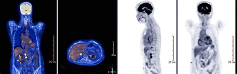 Image result for Open Pet Scan