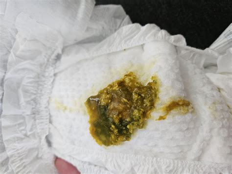 Green mucus in 7 week old's poop? : r/newborns