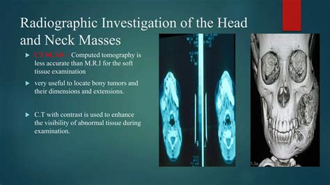 Neck mass differential diagnosis | PPTX