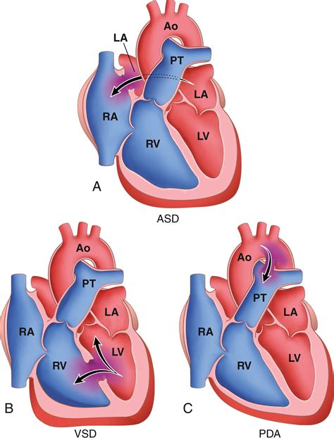 Heart - Clinical Tree