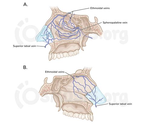 Paranasal Sinuses Drainage