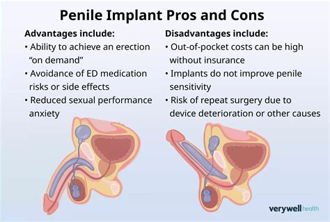 Botched Penis Implant