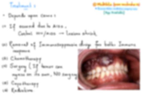 SOLUTION: Kaposis sarcoma - Studypool