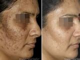 Isabel Vela Centro de Estética, NUEVO Cosmelan
