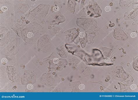 What Are Squamous Epithelial In Urine at Mai Lowder blog