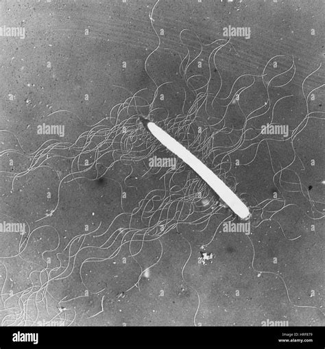 Proteus vulgaris bacteria, TEM Stock Photo - Alamy