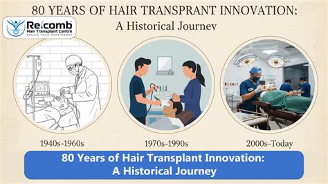 Best Hair Transplant Doctor in Surat|Best Hair Transplant Centre in ...