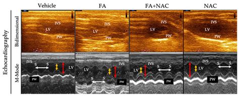 NAC Pre-Administration Prevents Cardiac Mitochondrial Bioenergetics ...