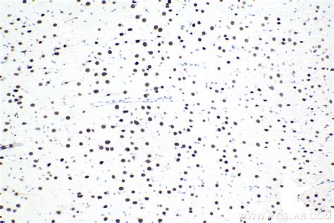 IHCeasy SATB1 Ready-To-Use IHC Kit KHC1666 | Proteintech