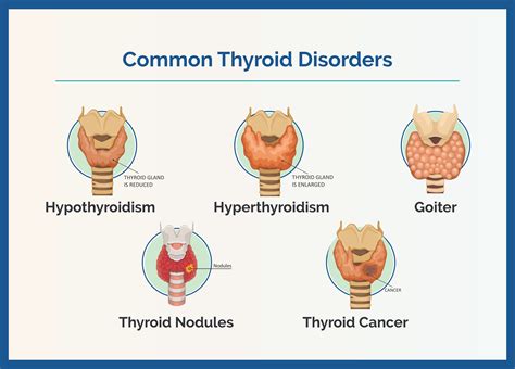 Understanding Disorders Of Thyroid Gland: Symptoms And Treatments Explained