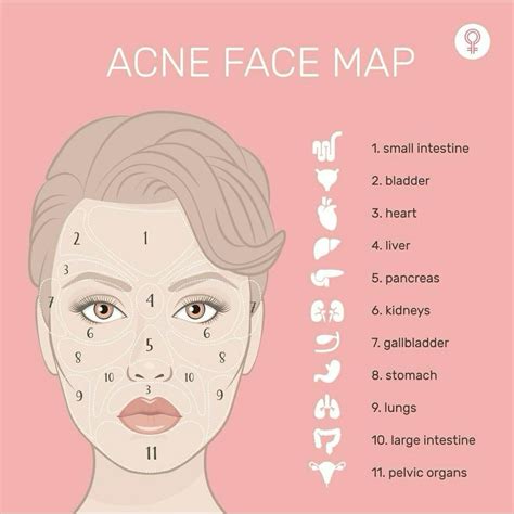 Acne face map – Artofit