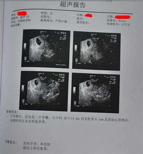 怀孕3周胎儿发育图_怀孕一个月胎儿发育过程图_孕妇常识_怀孕_太平洋亲子网