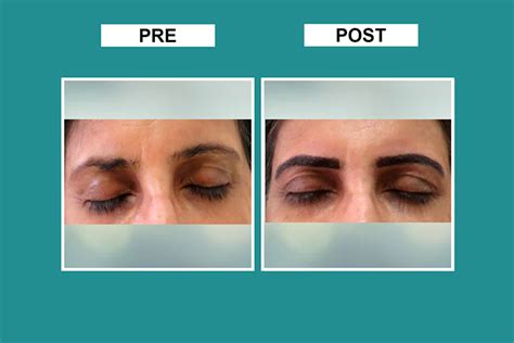 Cutis | Micro Blading