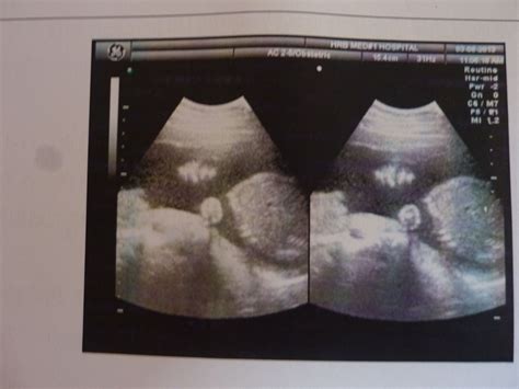 怀孕1~40周完整详细的胎儿发育过程图（彩色3D图） _生活提示_嘻嘻网