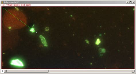 Image result for Image Processing Using ImageJ