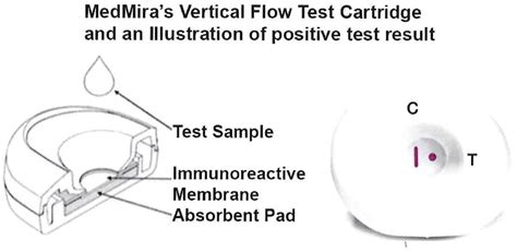 Trichomoniasis Images Men