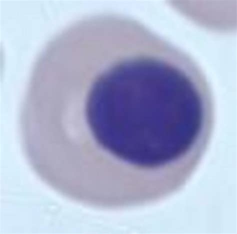 Nucleated Red Blood Cells