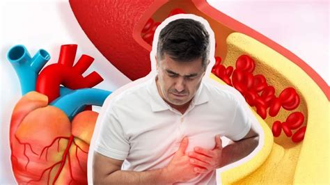 High Cholesterol | இரவில் ஏற்படும் இந்த 4 அறிகுறிகளை லேசாக எடுத்துக் ...