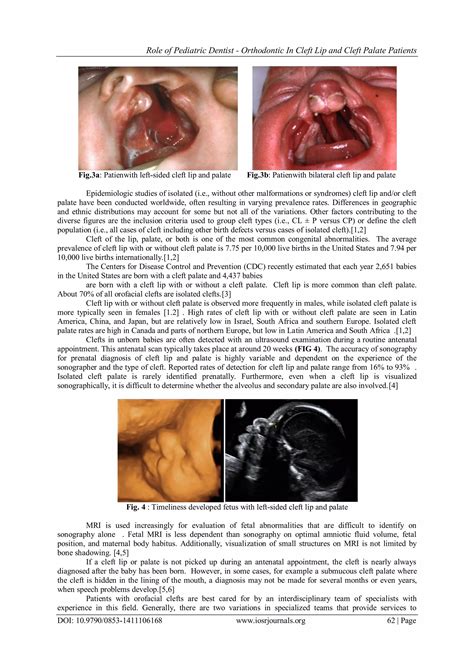 Role of pediatric dentist orthodontic in cleft lip and cleft palate patients | PDF