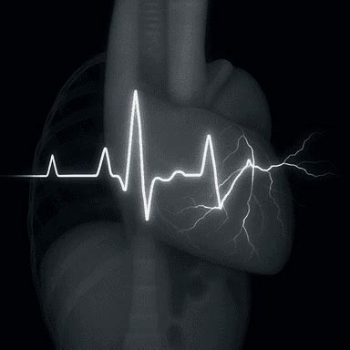 Heart Disease Risk Detection & Full Body Scan | Cent AI