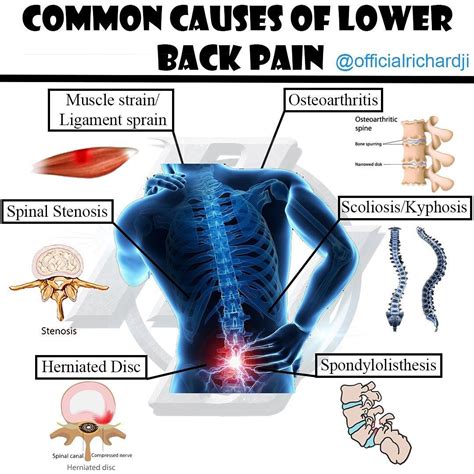 Lower Right Back Pain