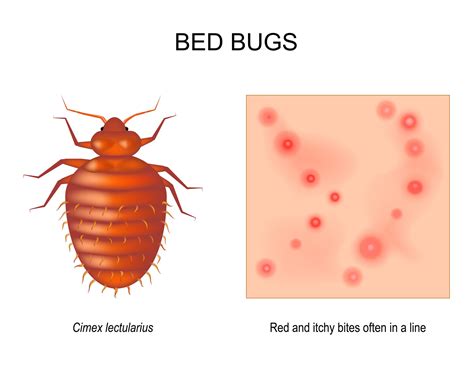 Bed Bugs Actual Size Chart Essentials