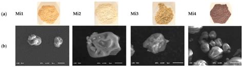 Comparison Study of Iron Bioaccessibility from Dietary Supplements and ...