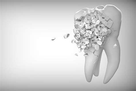 Image result for Pulled Tooth