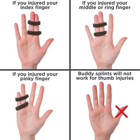Buddy tape splint wraps for jammed sprained dislocated or broken finger ...