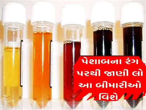 Urine Colors: પેશાબનો રંગ લાલ, પીળો, લીલો કે વાદળી હોય તો શું સમજવું ...