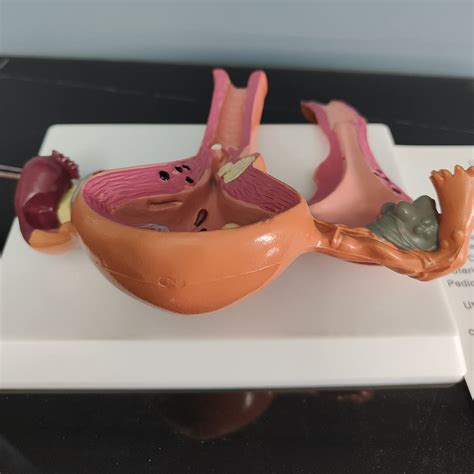 SIULAS Pathological Uterus Model - Life Size Human Uterus India | Ubuy