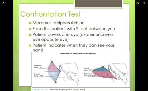 Image result for Confrontation Test for Visual Field