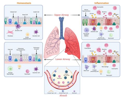Frontiers | A four-part guide to lung immunology: Invasion ...