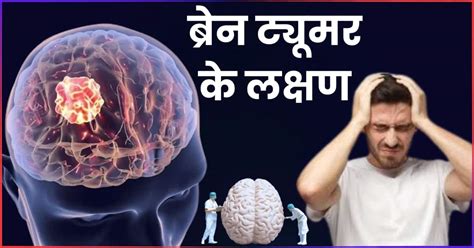 Brain Tumor Ke Shuruati Lakshan | ये 7 संकेत बताते हैं कि ब्रेन में बन ...