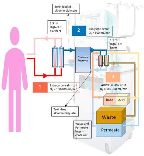 The ADVanced Organ Support (ADVOS) Hemodialysis System in Postoperative ...