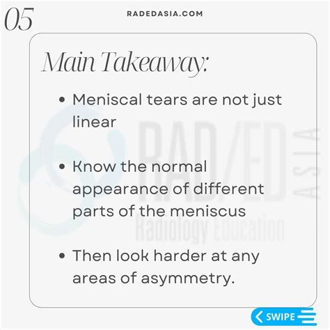 MENISCUS TEAR MRI KNEE: MISSING MENISCI WHAT TO LOOK FOR - Radedasia