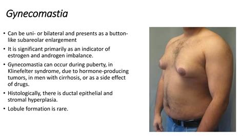 Breast pathology | PPTX