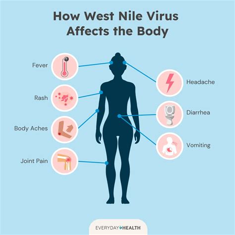 West Nile Virus: What It Is and How to Treat It