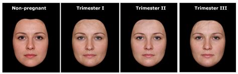 Flushed Face Pregnancy First Trimester at Leigh Clanton blog