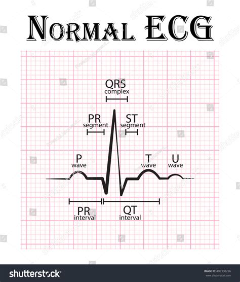 2,053 Normal Ecg Images, Stock Photos & Vectors | Shutterstock