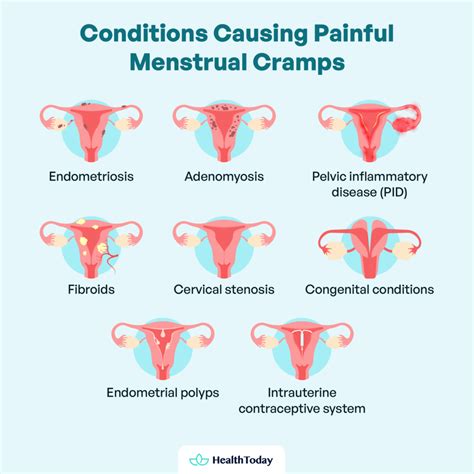 What Causes Period Cramps? Normal, Severe, and More - HealthToday
