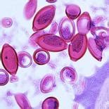 Weird Science Week: The gut and transportation edition - oregonlive.com