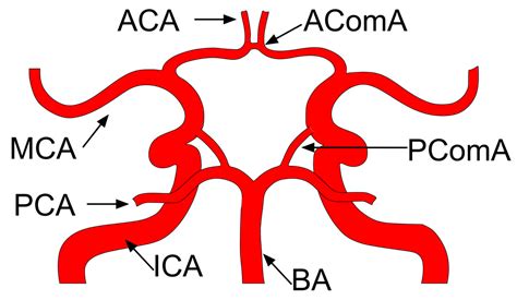 The Role of Hemodynamics through the Circle of Willis in the ...